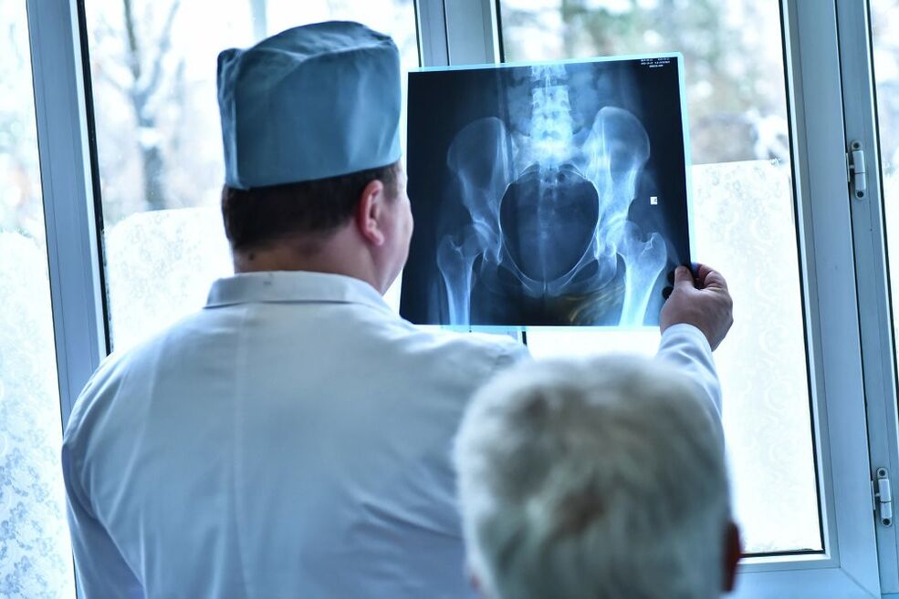 The doctor examines the image of a hip joint with arthrosis